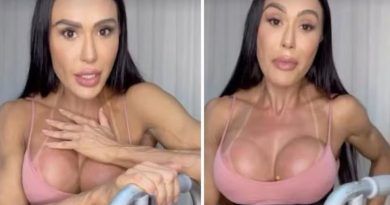 Gracyanne Barbosa dá detalhes sobre estado de saúde após acidente em assalto: 'Reaprendendo a andar'